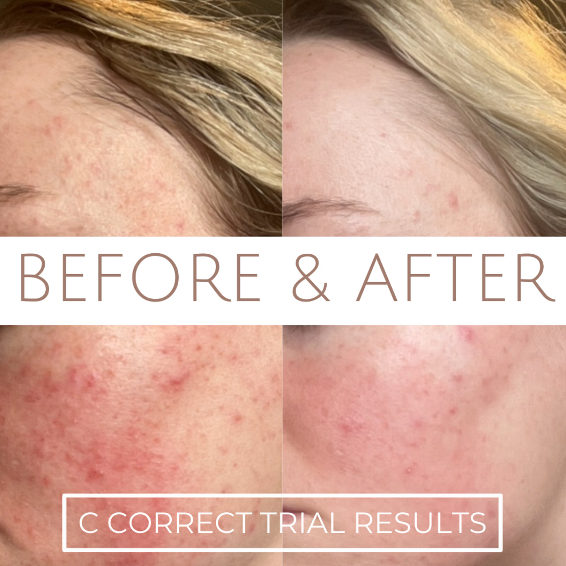 Glow Renew, aufhellende B & C Correct-Kollektion (Wert 203 £)
